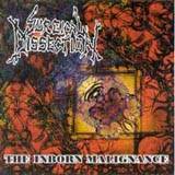 Surgical Dissection : The Inborn Malignance
